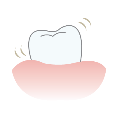 歯がぐらぐらする