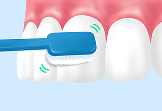 ブラッシング指導